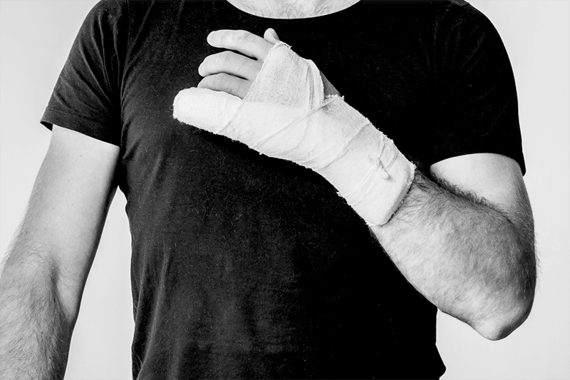 Injured worker with sprained hand in bandages
